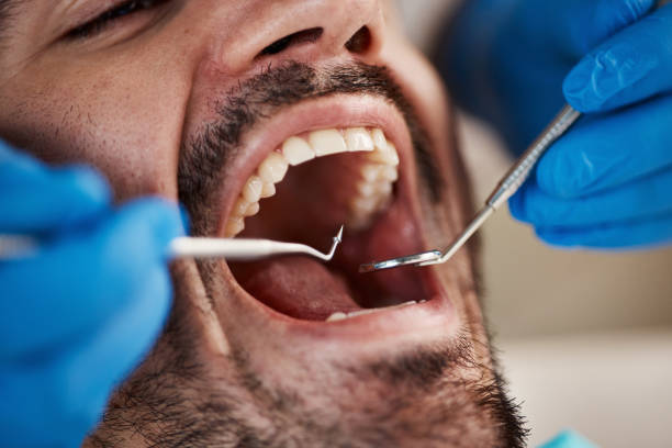 Best Teeth Whitening  in Salineville, OH